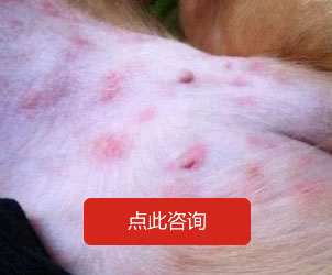 體股癬